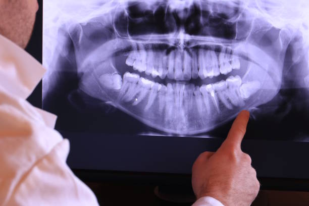 Best Tooth Infection Emergency Dentist  in Friars Point, MS